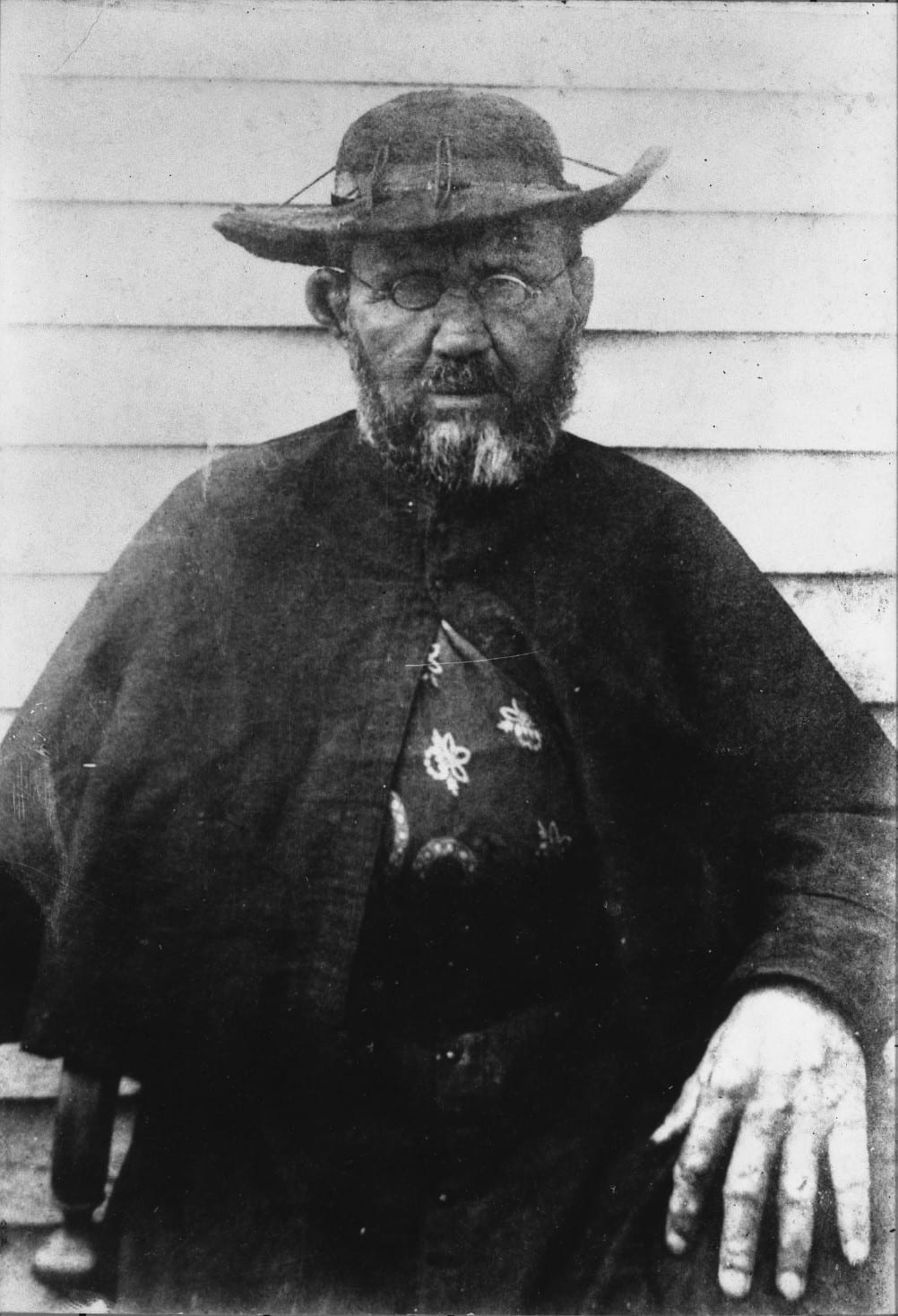 The Healing of Audrey Toguchi — Damien of Molokai's Canonization Miracle